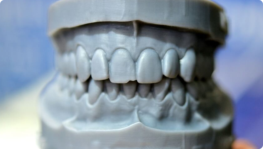 Impressão 3D em próteses dentárias desvendando desafios e oportunidades - LabClub Laboratório