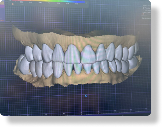 Design Digital de Próteses - LabClub Laboratório